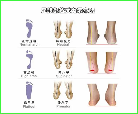 足跟部位受力示意图