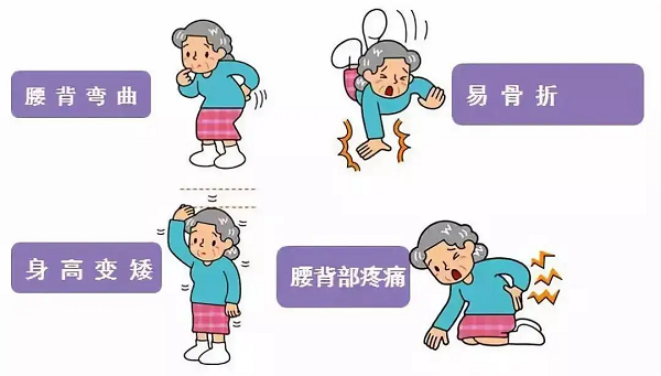 骨质疏松常见症状