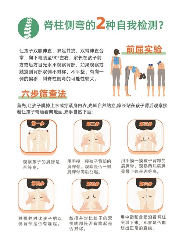 直乐医院脊柱侧弯六步筛查法