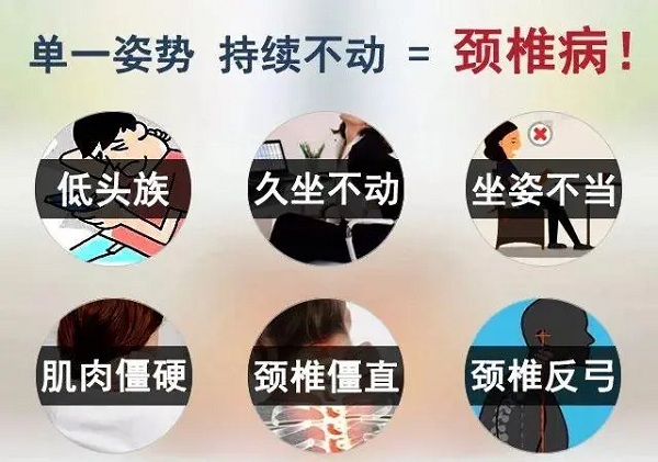 单一姿势持续不动=颈椎病