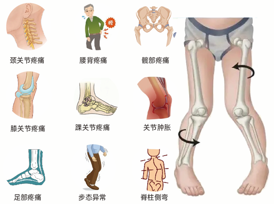 错误的下肢力线会导致什么