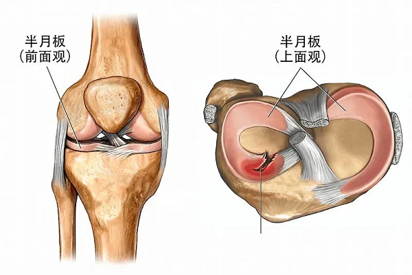 半月板前面观上面观